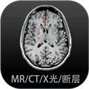 万能影音播放器